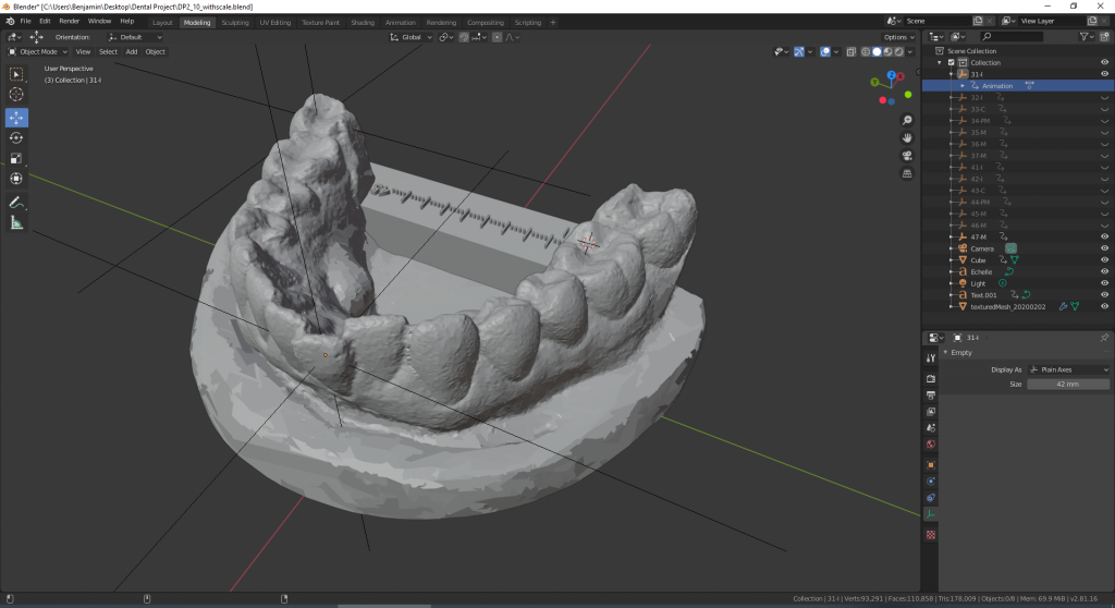 Ortho Project : 3D edition (step 3) – I'm sure I can